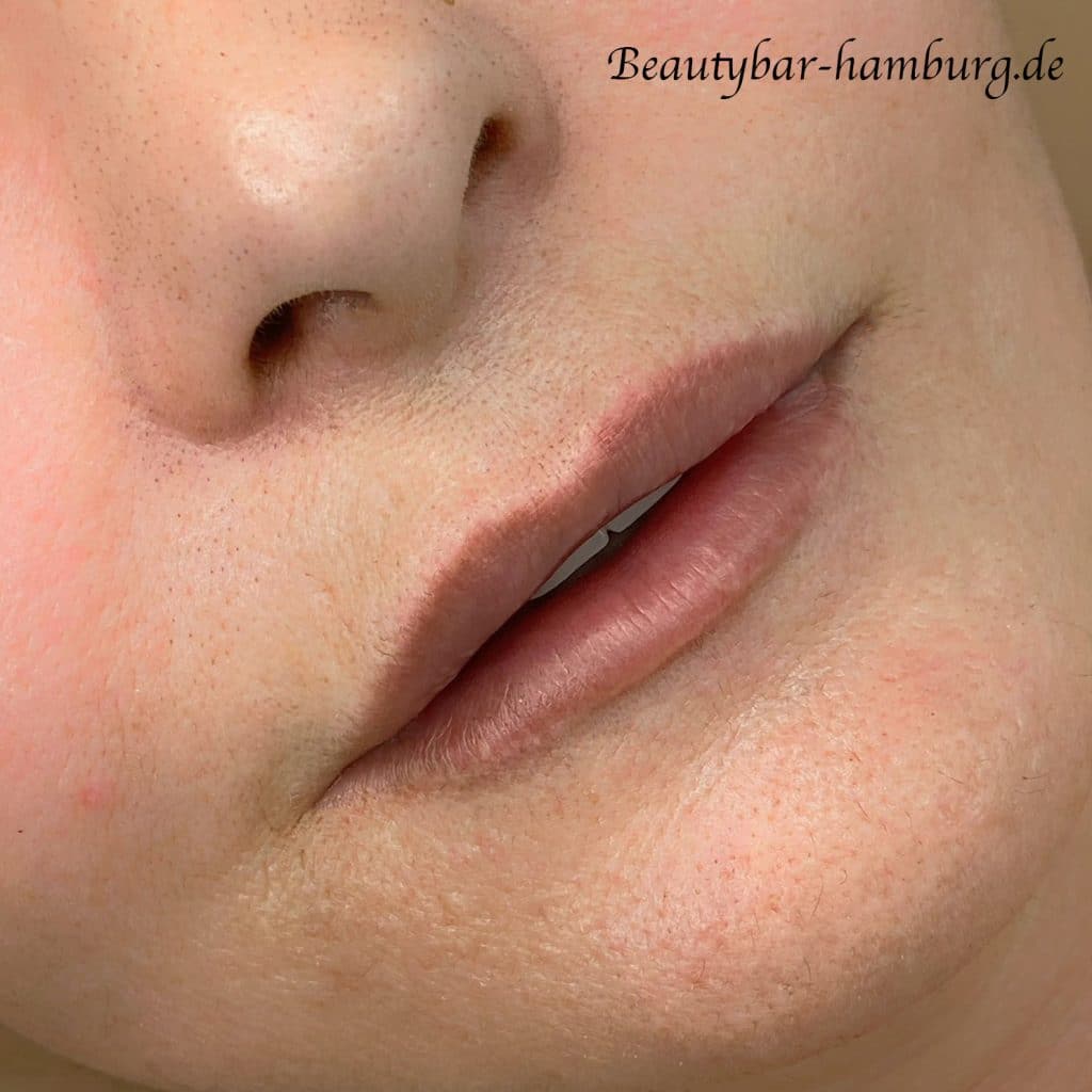 unbehandelter Aquarell Lippen Vorher: Natürliche Lippenfarbe und -struktur vor einer Pigmentierungsbehandlung. Beautybar-hamburg.de Wasserzeichen im Bild.