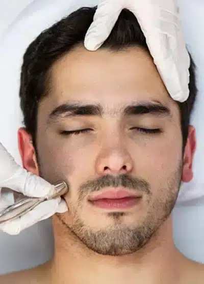 Mann mit geschlossenen Augen erhält eine Mikrodermabrasionsbehandlung im Gesicht bei Behnaz's Beauty Bar