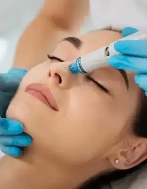Frau erhält eine Gesichtsbehandlung mit einem Mikrodermabrasionsgerät bei Behnaz's Beauty Bar