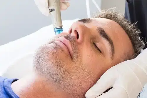 Mann erhält eine Gesichtsbehandlung mit einem Mikrodermabrasionsgerät bei Behnaz's Beauty Bar