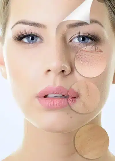 Gesicht einer Frau mit vergrößerten Ausschnitten der Haut zur Darstellung von Hautproblemen und Verbesserungen durch Behandlungen